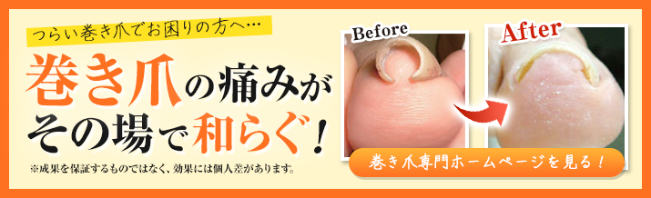 巻き爪の痛みがその場で和らぐ！